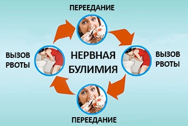 Лечение булимии в Нерчинском Заводе